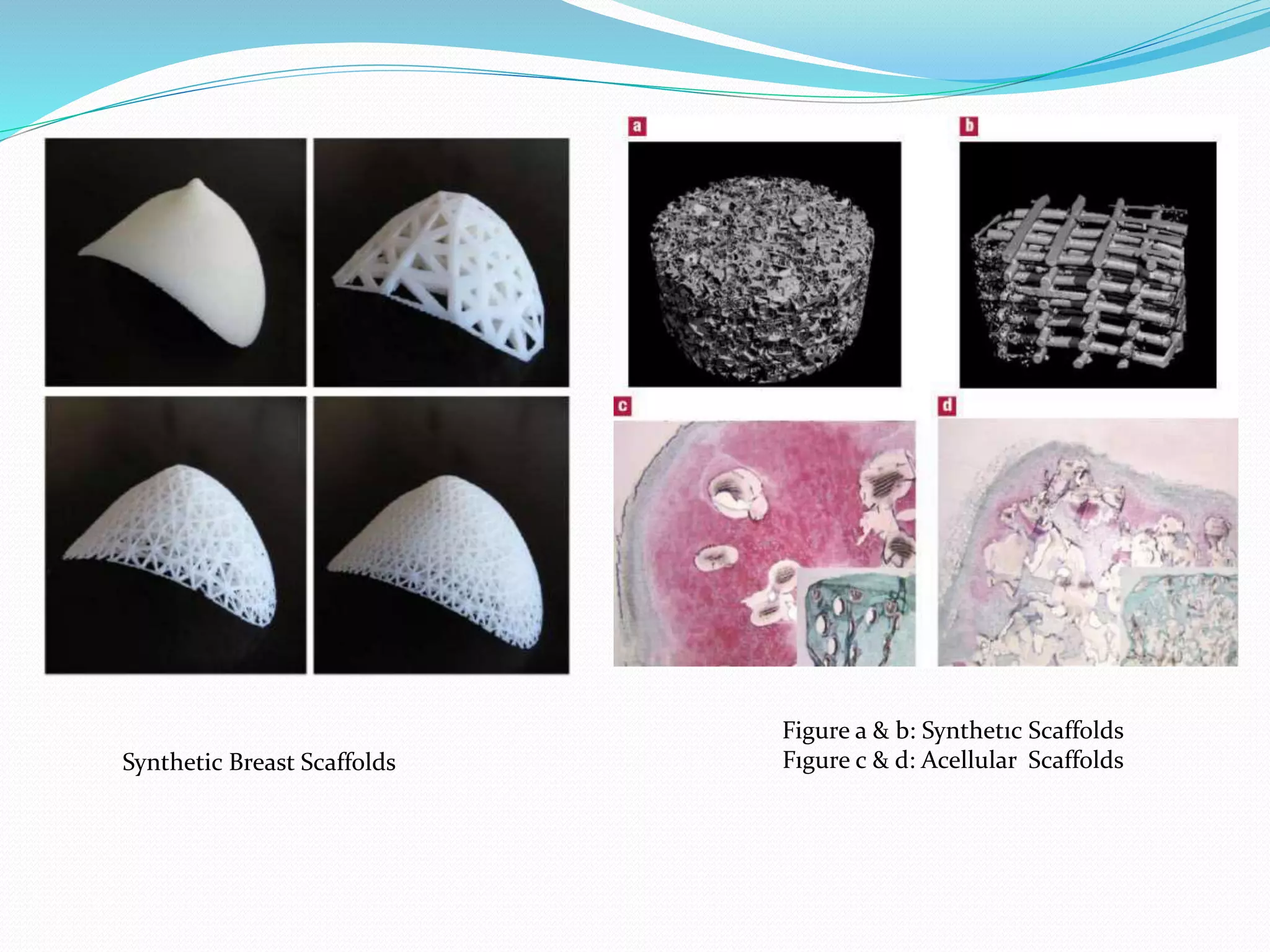 Synthetic Breast Scaffolds
Figure a & b: Synthetıc Scaffolds
Fıgure c & d: Acellular Scaffolds
 
