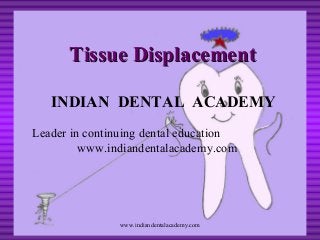 Tissue Displacement
INDIAN DENTAL ACADEMY
Leader in continuing dental education
www.indiandentalacademy.com

www.indiandentalacademy.com

 