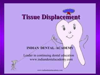 Tissue DisplacementTissue Displacement
INDIAN DENTAL ACADEMY
Leader in continuing dental education
www.indiandentalacademy.com
www.indiandentalacademy.com
 