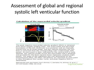 Assessment of global and regional
systolic left venticular function
 