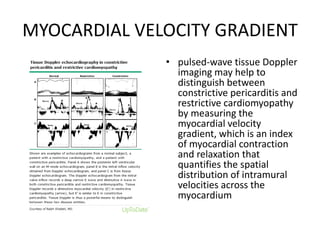 MYOCARDIAL VELOCITY GRADIENT
• pulsed-wave tissue Doppler
imaging may help to
distinguish between
constrictive pericarditis and
restrictive cardiomyopathy
by measuring the
myocardial velocity
gradient, which is an index
of myocardial contraction
and relaxation that
quantifies the spatial
distribution of intramural
velocities across the
myocardium
 