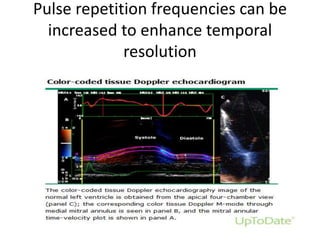 Pulse repetition frequencies can be
increased to enhance temporal
resolution
 