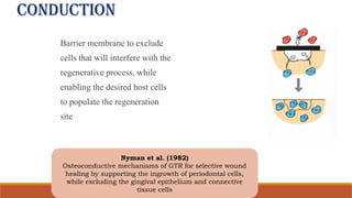 conduction
Barrier membrane to exclude
cells that will interfere with the
regenerative process, while
enabling the desired host cells
to populate the regeneration
site
Nyman et al. (1982)
Osteoconductive mechanisms of GTR for selective wound
healing by supporting the ingrowth of periodontal cells,
while excluding the gingival epithelium and connective
tissue cells
 