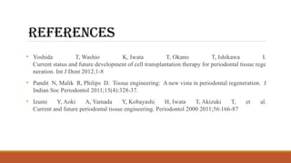 REFERENCES
• Yoshida T, Washio K, Iwata T, Okano T, Ishikawa I.
Current status and future development of cell transplantation therapy for periodontal tissue rege
neration. Int J Dent 2012;1-8
• Pandit N, Malik R, Philips D. Tissue engineering: A new vista in periodontal regeneration. J
Indian Soc Periodontol 2011;15(4):328-37.
• Izumi Y, Aoki A, Yamada Y, Kobayashi H, Iwata T, Akizuki T, et al.
Current and future periodontal tissue engineering. Periodontol 2000 2011;56:166-87
 