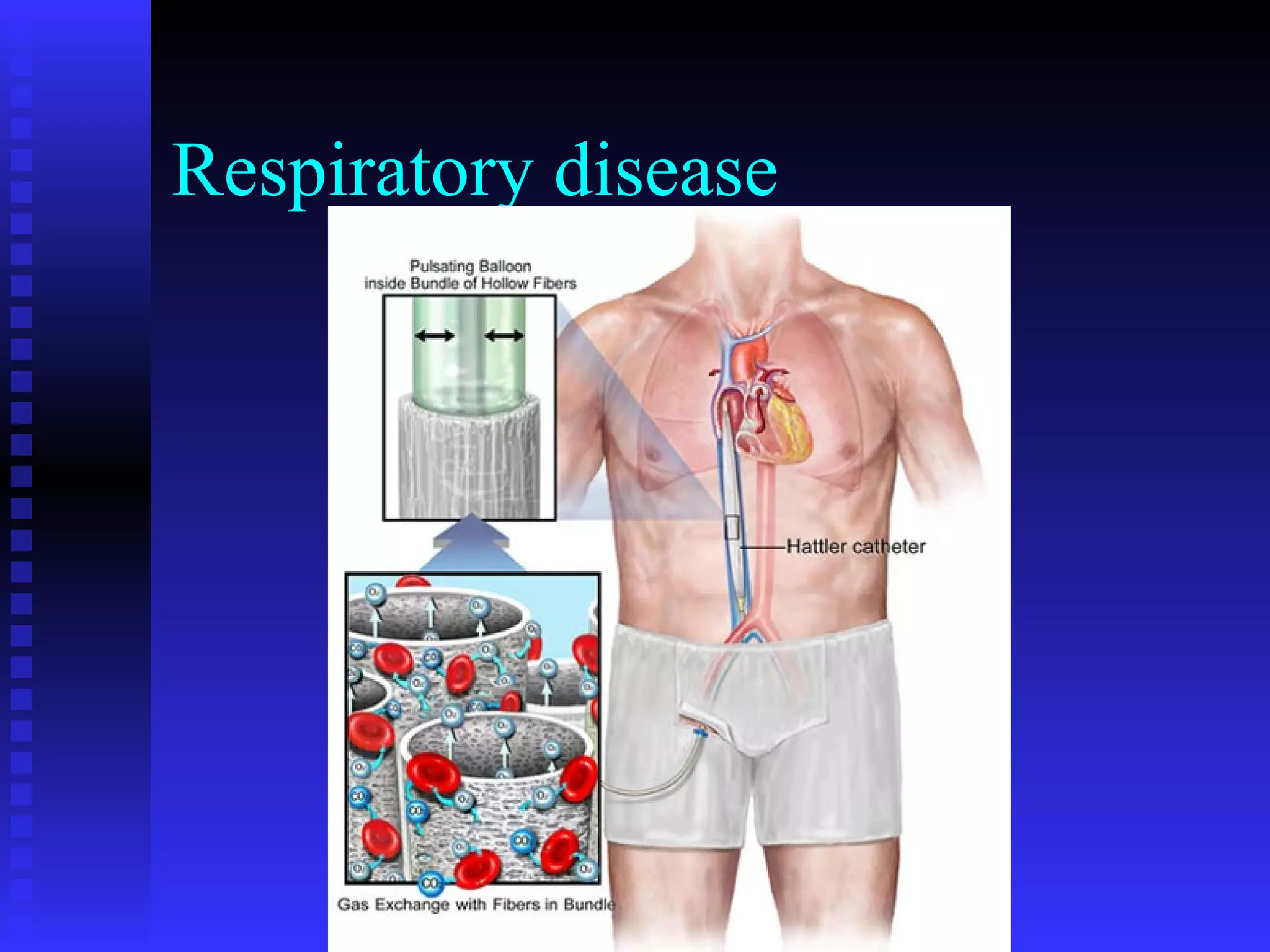 Respiratory disease 