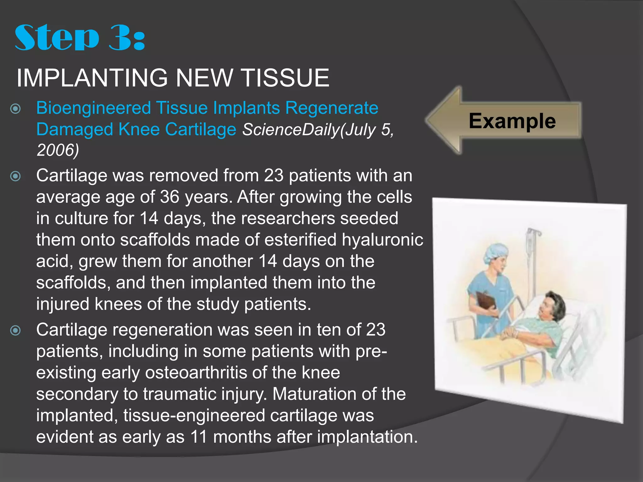 Step 3:
IMPLANTING NEW TISSUE
   Bioengineered Tissue Implants Regenerate
    Damaged Knee Cartilage ScienceDaily(July 5,         Example
    2006)
   Cartilage was removed from 23 patients with an
    average age of 36 years. After growing the cells
    in culture for 14 days, the researchers seeded
    them onto scaffolds made of esterified hyaluronic
    acid, grew them for another 14 days on the
    scaffolds, and then implanted them into the
    injured knees of the study patients.
   Cartilage regeneration was seen in ten of 23
    patients, including in some patients with pre-
    existing early osteoarthritis of the knee
    secondary to traumatic injury. Maturation of the
    implanted, tissue-engineered cartilage was
    evident as early as 11 months after implantation.
 