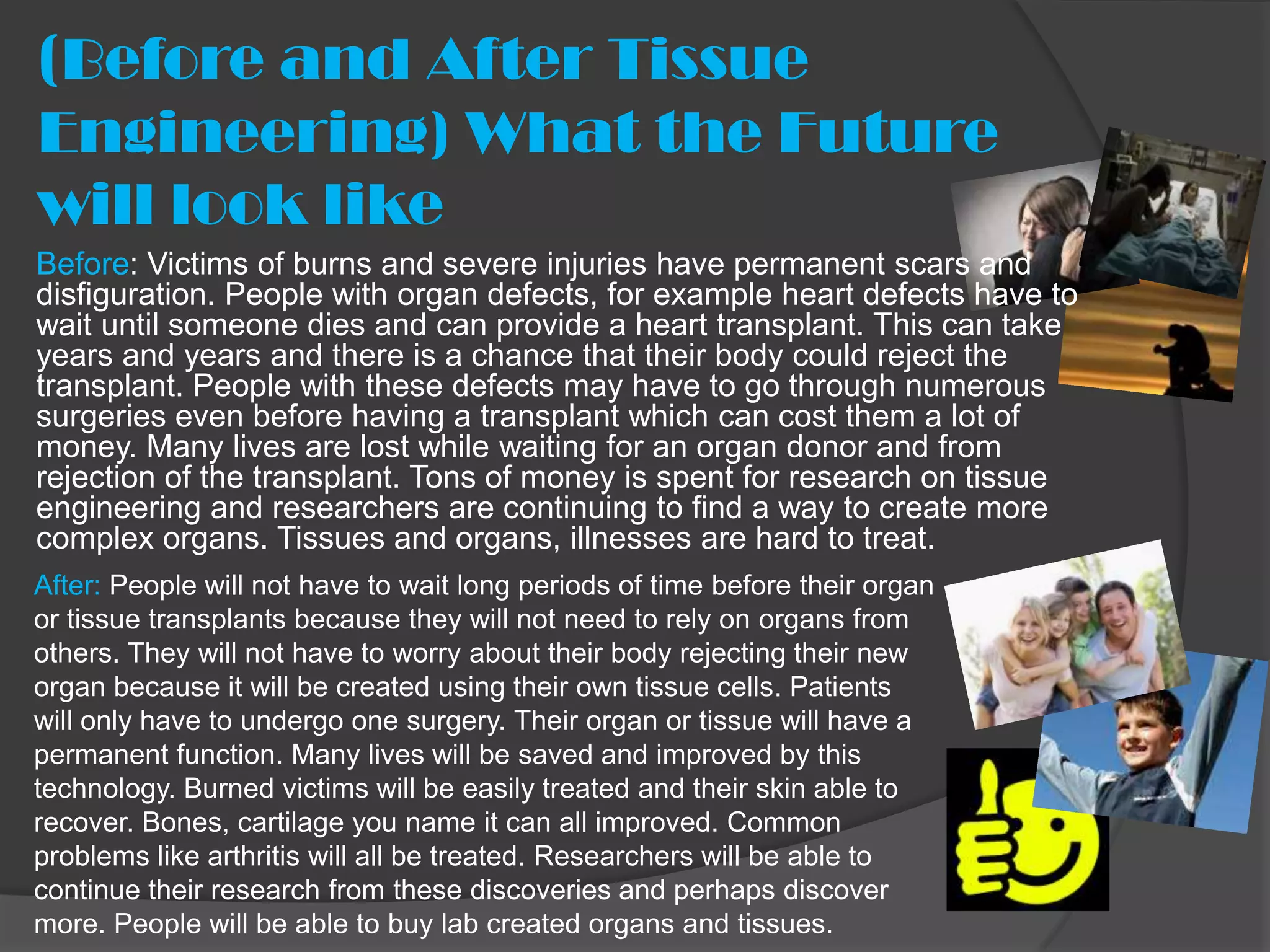 (Before and After Tissue
Engineering) What the Future
will look like
Before: Victims of burns and severe injuries have permanent scars and
disfiguration. People with organ defects, for example heart defects have to
wait until someone dies and can provide a heart transplant. This can take
years and years and there is a chance that their body could reject the
transplant. People with these defects may have to go through numerous
surgeries even before having a transplant which can cost them a lot of
money. Many lives are lost while waiting for an organ donor and from
rejection of the transplant. Tons of money is spent for research on tissue
engineering and researchers are continuing to find a way to create more
complex organs. Tissues and organs, illnesses are hard to treat.
After: People will not have to wait long periods of time before their organ
or tissue transplants because they will not need to rely on organs from
others. They will not have to worry about their body rejecting their new
organ because it will be created using their own tissue cells. Patients
will only have to undergo one surgery. Their organ or tissue will have a
permanent function. Many lives will be saved and improved by this
technology. Burned victims will be easily treated and their skin able to
recover. Bones, cartilage you name it can all improved. Common
problems like arthritis will all be treated. Researchers will be able to
continue their research from these discoveries and perhaps discover
more. People will be able to buy lab created organs and tissues.
 