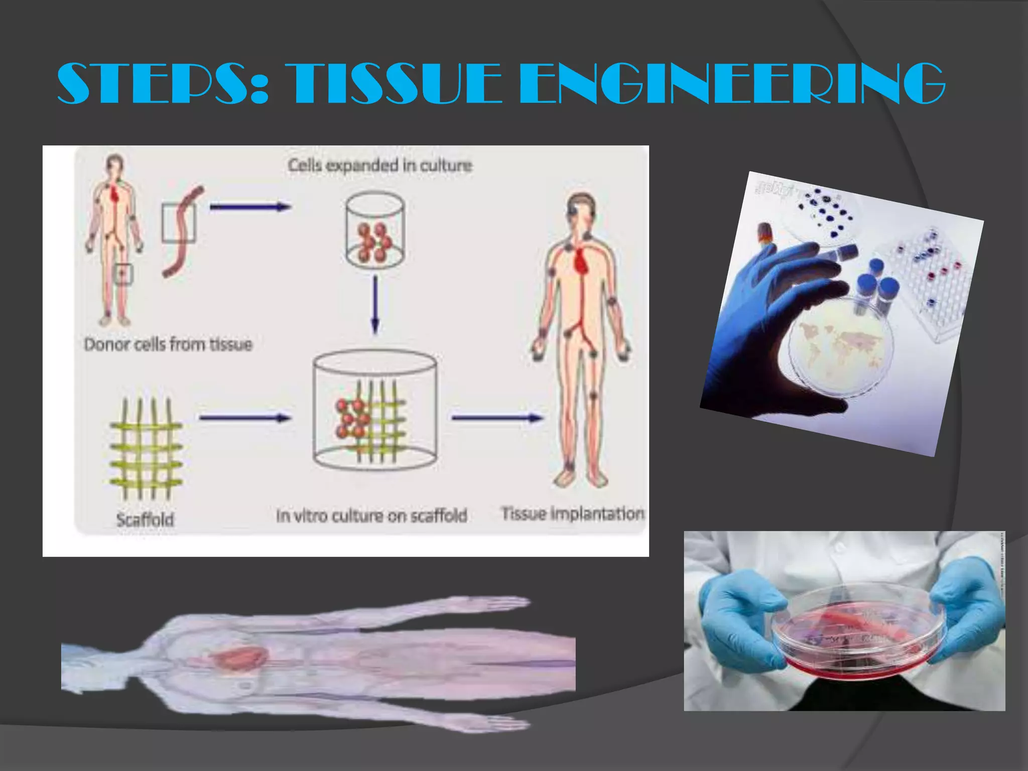 STEPS: TISSUE ENGINEERING
 