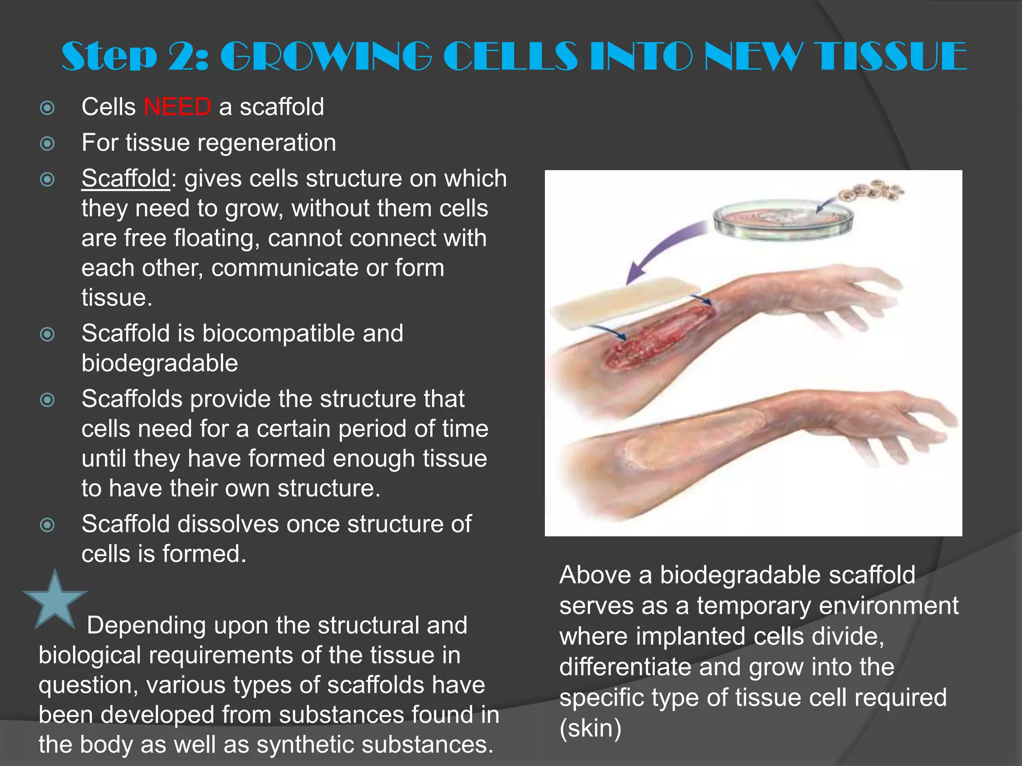 Step 2: GROWING CELLS INTO NEW TISSUE
   Cells NEED a scaffold
   For tissue regeneration
   Scaffold: gives cells structure on which
    they need to grow, without them cells
    are free floating, cannot connect with
    each other, communicate or form
    tissue.
   Scaffold is biocompatible and
    biodegradable
   Scaffolds provide the structure that
    cells need for a certain period of time
    until they have formed enough tissue
    to have their own structure.
   Scaffold dissolves once structure of
    cells is formed.
                                               Above a biodegradable scaffold
                                               serves as a temporary environment
     Depending upon the structural and         where implanted cells divide,
biological requirements of the tissue in       differentiate and grow into the
question, various types of scaffolds have
                                               specific type of tissue cell required
been developed from substances found in
                                               (skin)
the body as well as synthetic substances.
 