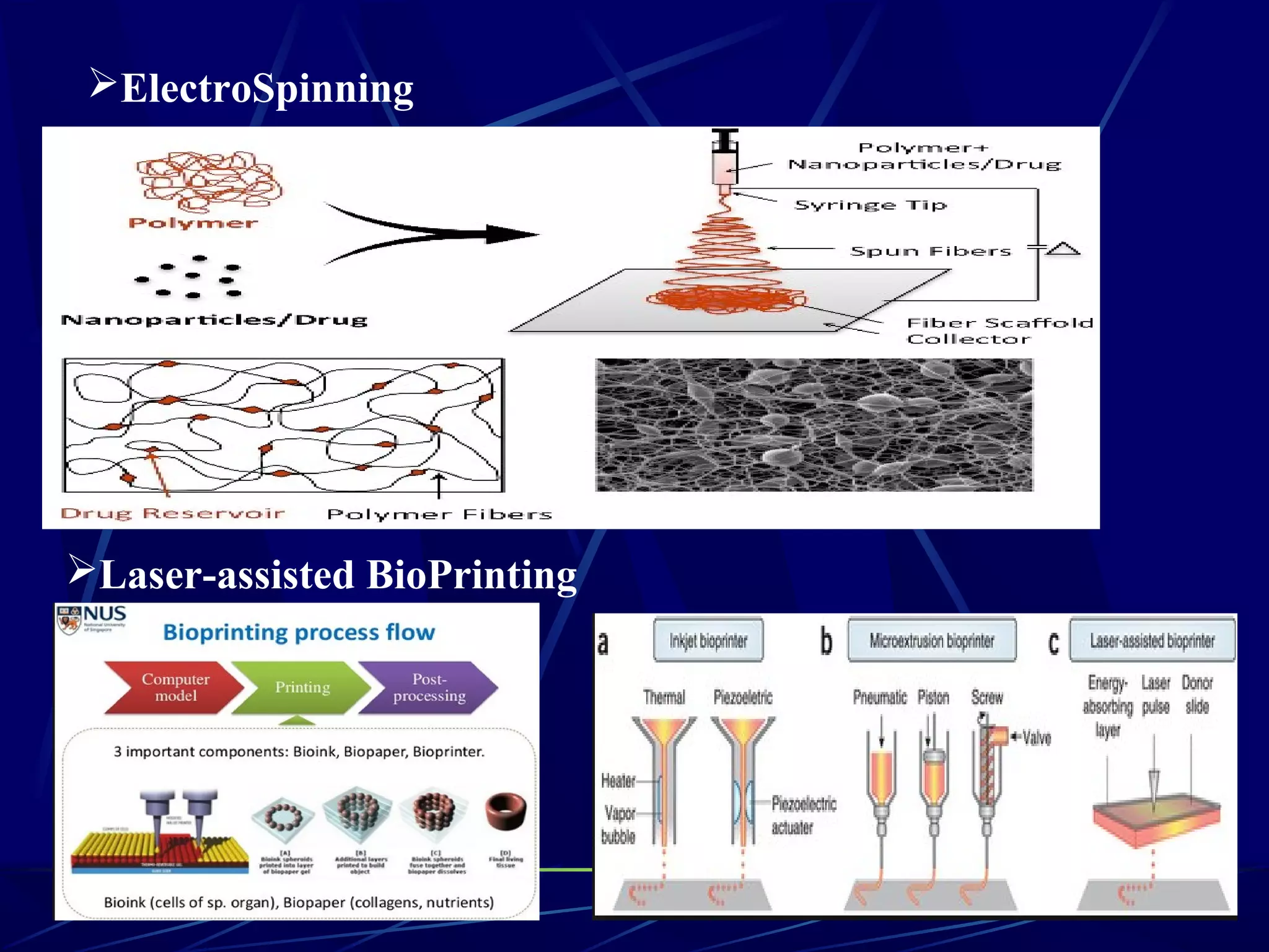 ElectroSpinning
Laser-assisted BioPrinting
(LaBP)
 