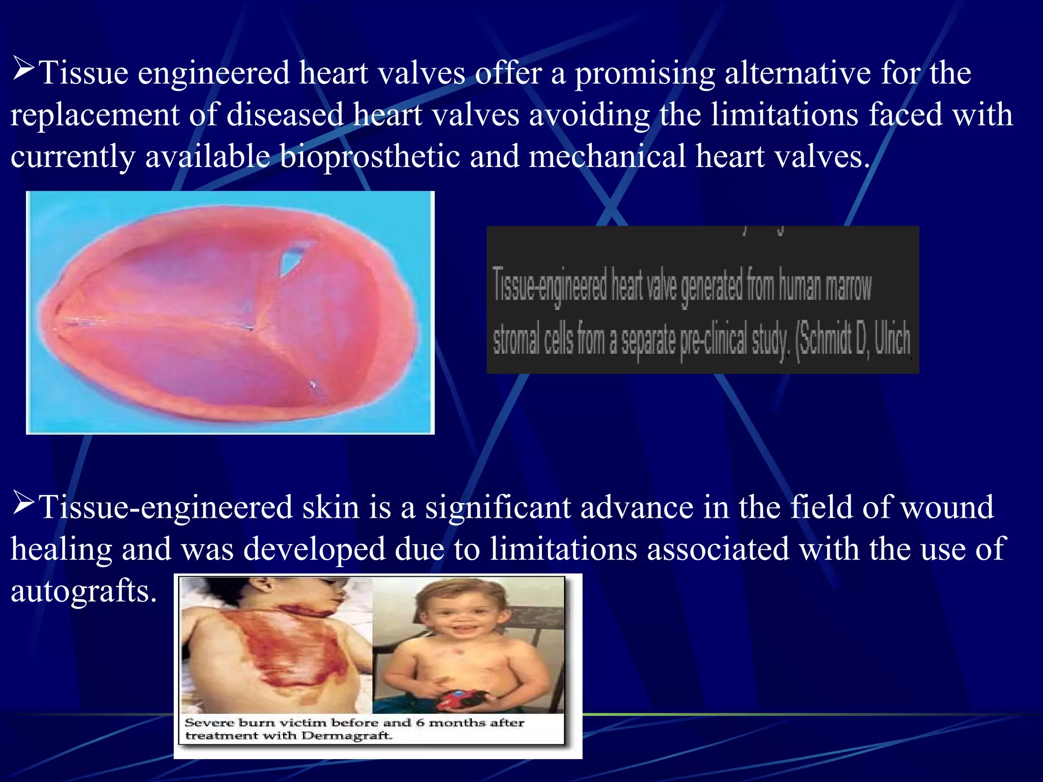 Tissue engineered heart valves offer a promising alternative for the
replacement of diseased heart valves avoiding the limitations faced with
currently available bioprosthetic and mechanical heart valves.
Tissue-engineered skin is a significant advance in the field of wound
healing and was developed due to limitations associated with the use of
autografts.
 