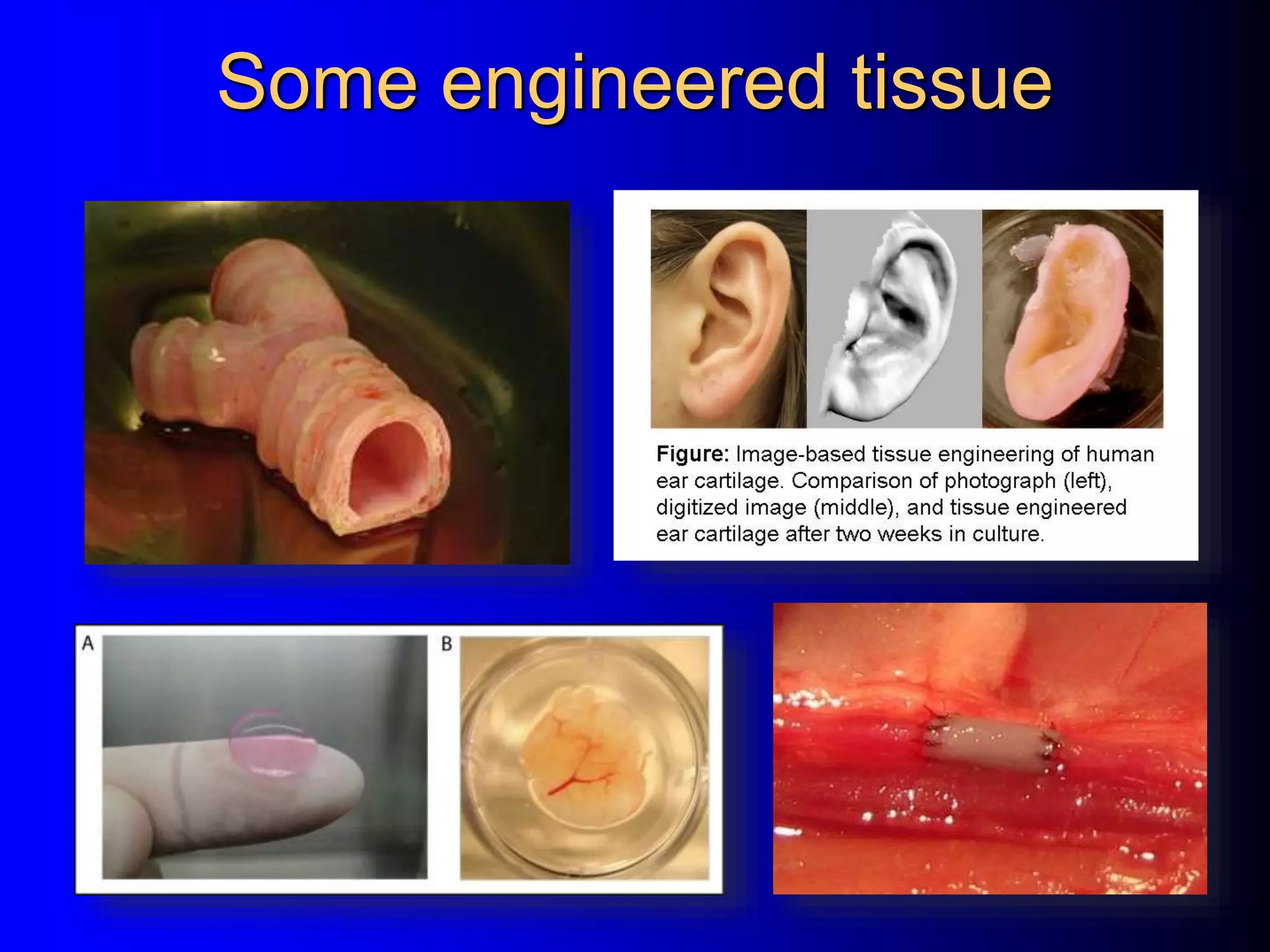 Some engineered tissue
 