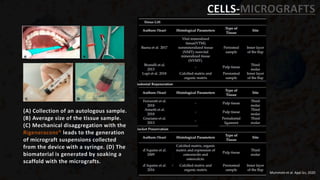 CELLS-MICROGRAFTS
Mummolo et al. Appl Sci, 2020
(A) Collection of an autologous sample.
(B) Average size of the tissue sample.
(C) Mechanical disaggregation with the
Rigeneracons® leads to the generation
of micrograft suspensions collected
from the device with a syringe. (D) The
biomaterial is generated by soaking a
scaffold with the micrografts.
 