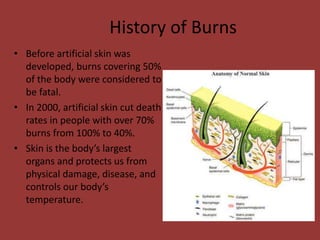 History of Burns
• Before artificial skin was
developed, burns covering 50%
of the body were considered to
be fatal.
• In 2000, artificial skin cut death
rates in people with over 70%
burns from 100% to 40%.
• Skin is the body’s largest
organs and protects us from
physical damage, disease, and
controls our body’s
temperature.
 