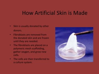 How Artificial Skin is Made
• Skin is usually donated by other
donors.
• Fibroblasts are removed from
the donated skin and are frozen
until they are needed.
• The fibroblasts are placed on a
polymeric mesh scaffolding,
gather oxygen, and grow new
cells.
• The cells are then transferred to
a culture system.
 