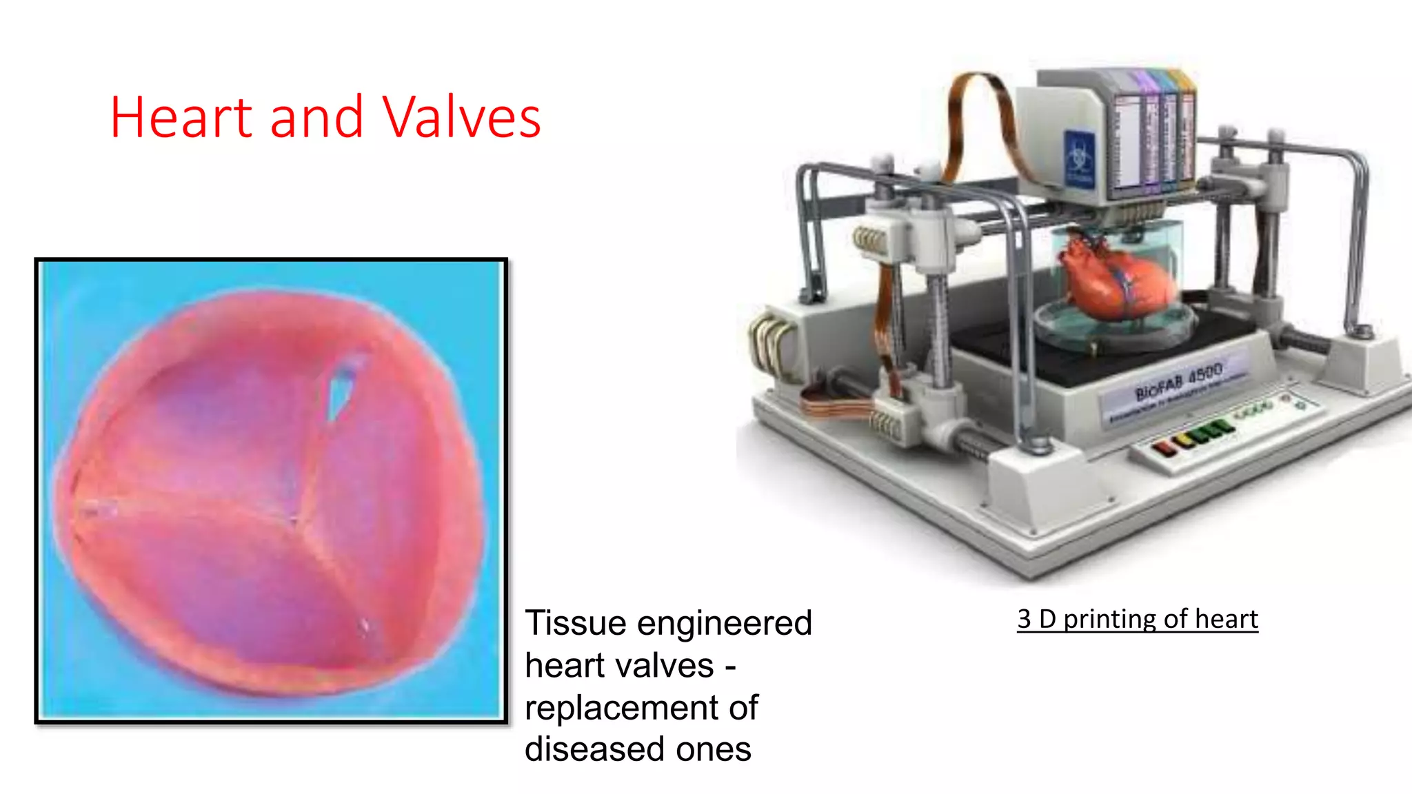 Heart and Valves
Tissue engineered
heart valves -
replacement of
diseased ones
3 D printing of heart
 
