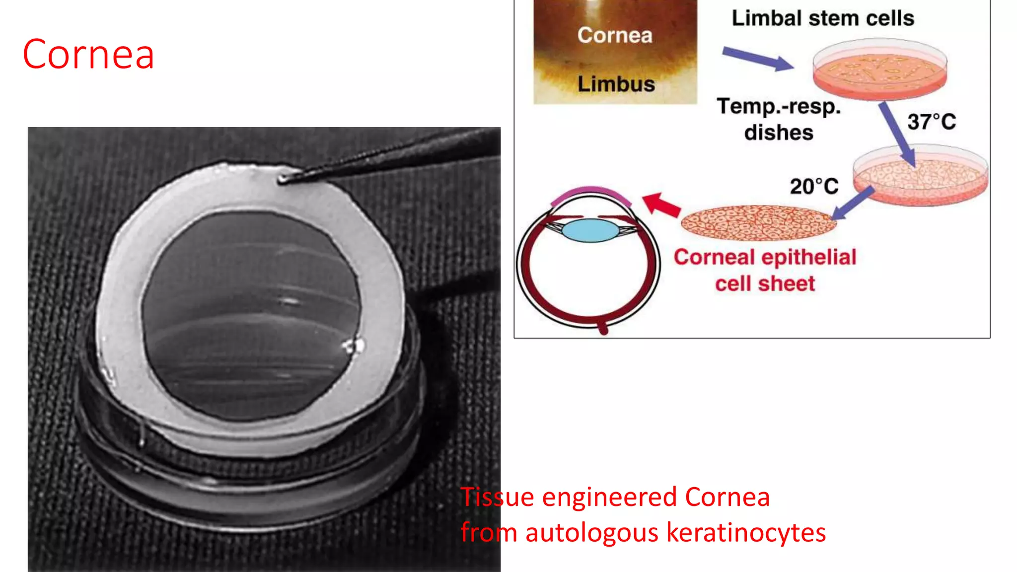 Cornea
Tissue engineered Cornea
from autologous keratinocytes
 