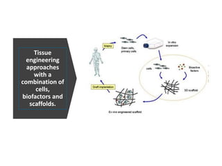 Tissue
engineering
approaches
with a
combination of
cells,
biofactors and
scaffolds.
 