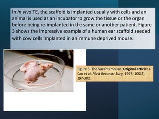 In In vivo TE, the scaffold is implanted usually with cells and an
animal is used as an incubator to grow the tissue or the organ
before being re-implanted in the same or another patient. Figure
3 shows the impressive example of a human ear scaffold seeded
with cow cells implanted in an immune deprived mouse.
Figure 3. The Vacanti mouse. Original article: Y.
Cao et al. Plast Reconstr Surg, 1997; 100(2),
297-302.
 