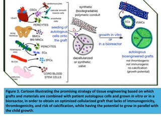 Figure 3. Cartoon illustrating the promising strategy of tissue engineering based on which
grafts and materials are combined with patient autologous cells and grown in vitro or in a
bioreactor, in order to obtain an optimized cellularized graft that lacks of immunogenicity,
thrombogenicity, and risk of calcification, while having the potential to grow in parallel with
the child growth.
 