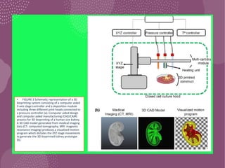 • FIGURE 3 Schematic representation of a 3D
bioprinting system consisting of a computer aided
3-axis stage controller and a deposition module
including three different print heads connected to
a pressure controller (a). Computer aided design
and computer aided manufacturing (CAD/CAM)
process for 3D bioprinting of a human size kidney.
A 3D CAD model generated from medical imaging
data (CT: computed tomography; MRI: magnetic
resonance imaging) produces a visualized motion
program which dictates the XYZ stage movements
to generate the 3D bioprinted kidney prototype
(b).
 