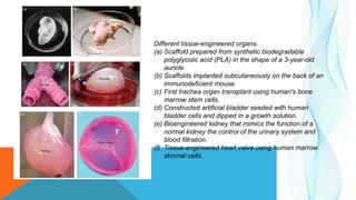 Different tissue-engineered organs.
(a) Scaffold prepared from synthetic biodegradable
polyglycolic acid (PLA) in the shape of a 3-year-old
auricle.
(b) Scaffolds implanted subcutaneously on the back of an
immunodeficient mouse.
(c) First trachea organ transplant using human's bone
marrow stem cells.
(d) Constructed artificial bladder seeded with human
bladder cells and dipped in a growth solution.
(e) Bioengineered kidney that mimics the function of a
normal kidney the control of the urinary system and
blood filtration.
(f) Tissue-engineered heart valve using human marrow
stromal cells.
 