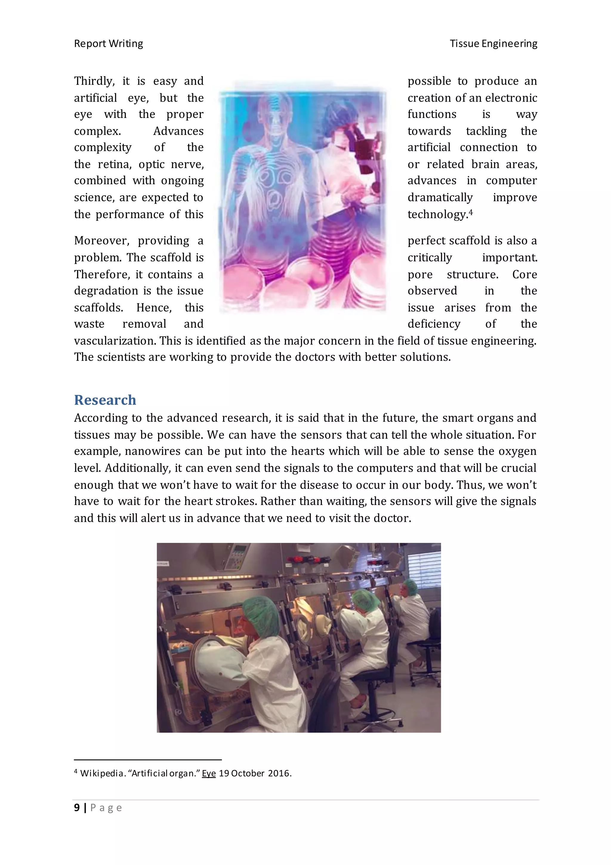 Report Writing Tissue Engineering
9 | P a g e
Thirdly, it is easy and possible to produce an
artificial eye, but the creation of an electronic
eye with the proper functions is way
complex. Advances towards tackling the
complexity of the artificial connection to
the retina, optic nerve, or related brain areas,
combined with ongoing advances in computer
science, are expected to dramatically improve
the performance of this technology.4
Moreover, providing a perfect scaffold is also a
problem. The scaffold is critically important.
Therefore, it contains a pore structure. Core
degradation is the issue observed in the
scaffolds. Hence, this issue arises from the
waste removal and deficiency of the
vascularization. This is identified as the major concern in the field of tissue engineering.
The scientists are working to provide the doctors with better solutions.
Research
According to the advanced research, it is said that in the future, the smart organs and
tissues may be possible. We can have the sensors that can tell the whole situation. For
example, nanowires can be put into the hearts which will be able to sense the oxygen
level. Additionally, it can even send the signals to the computers and that will be crucial
enough that we won’t have to wait for the disease to occur in our body. Thus, we won’t
have to wait for the heart strokes. Rather than waiting, the sensors will give the signals
and this will alert us in advance that we need to visit the doctor.
4 Wikipedia.“Artificial organ.” Eye 19 October 2016.
 