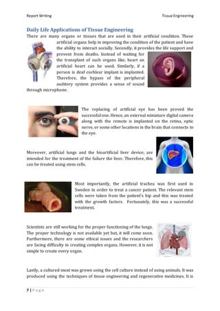 Report Writing Tissue Engineering
7 | P a g e
Daily Life Applications of Tissue Engineering
There are many organs or tissues that are used in their artificial condition. These
artificial organs help in improving the condition of the patient and have
the ability to interact socially. Secondly, it provides the life support and
prevent from deaths. Instead of waiting for
the transplant of such organs like, heart an
artificial heart can be used. Similarly, if a
person is deaf cochlear implant is implanted.
Therefore, the bypass of the peripheral
auditory system provides a sense of sound
through microphone.
The replacing of artificial eye has been proved the
successful one. Hence, an external miniature digital camera
along with the remote is implanted on the retina, optic
nerve, or some other locations in the brain that connects to
the eye.
Moreover, artificial lungs and the bioartificial liver device; are
intended for the treatment of the failure the liver. Therefore, this
can be treated using stem cells.
Most importantly, the artificial trachea was first used in
Sweden in order to treat a cancer patient. The relevant stem
cells were taken from the patient’s hip and this was treated
with the growth factors. Fortunately, this was a successful
treatment.
Scientists are still working for the proper functioning of the lungs.
The proper technology is not available yet but, it will come soon.
Furthermore, there are some ethical issues and the researchers
are facing difficulty in creating complex organs. However, it is not
simple to create every organ.
Lastly, a cultured meat was grown using the cell culture instead of using animals. It was
produced using the techniques of tissue engineering and regenerative medicines. It is
 