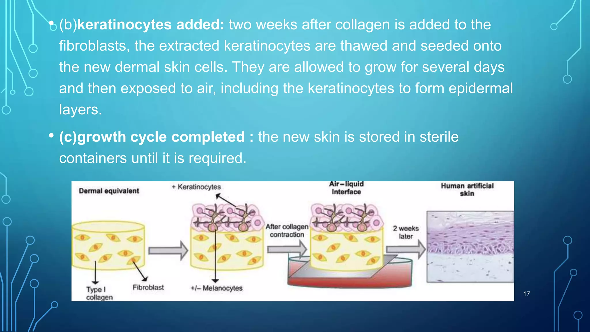 • (b)keratinocytes added: two weeks after collagen is added to the
fibroblasts, the extracted keratinocytes are thawed and seeded onto
the new dermal skin cells. They are allowed to grow for several days
and then exposed to air, including the keratinocytes to form epidermal
layers.
• (c)growth cycle completed : the new skin is stored in sterile
containers until it is required.
5/15/2020 17
 