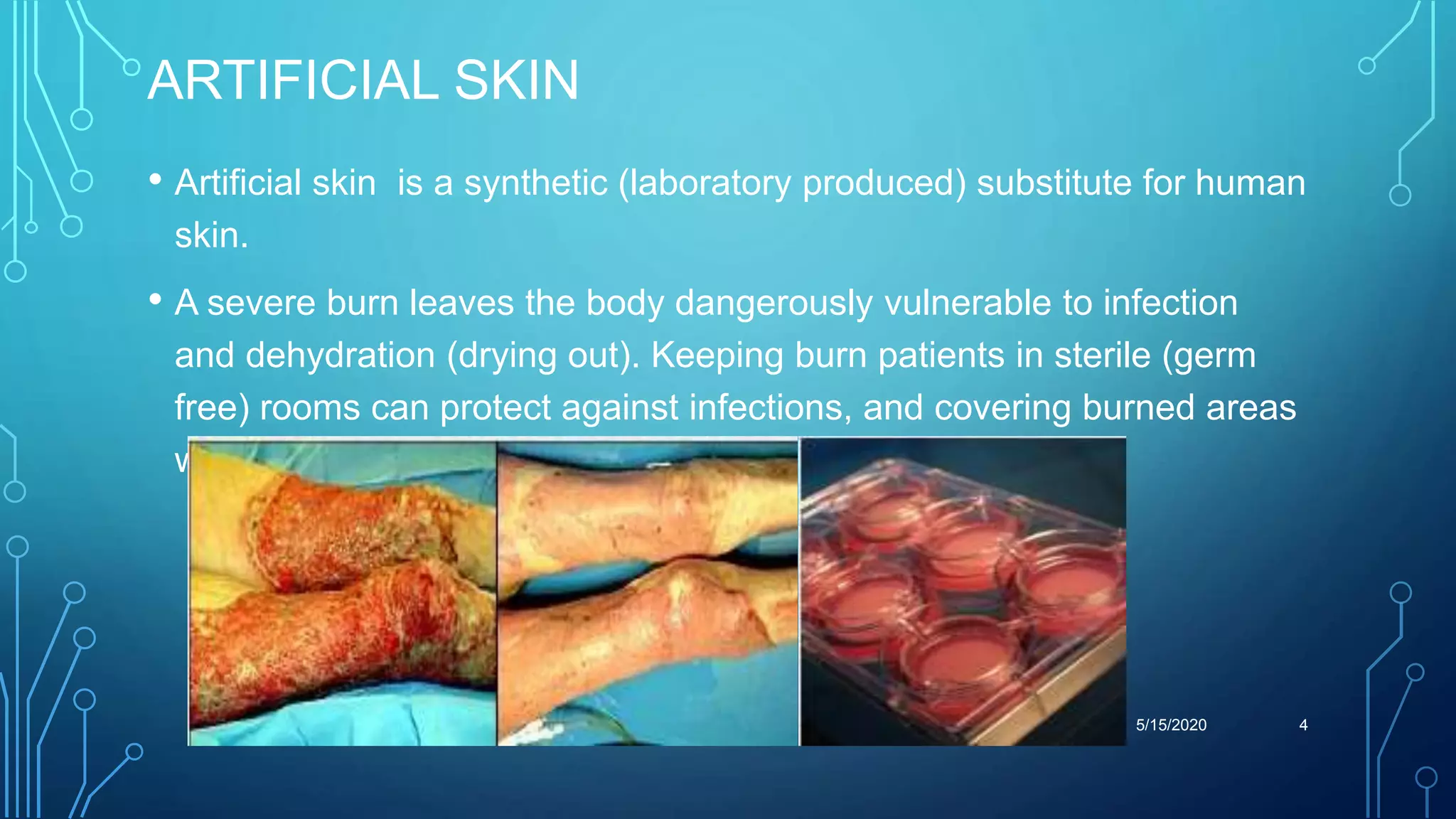 ARTIFICIAL SKIN
• Artificial skin is a synthetic (laboratory produced) substitute for human
skin.
• A severe burn leaves the body dangerously vulnerable to infection
and dehydration (drying out). Keeping burn patients in sterile (germ
free) rooms can protect against infections, and covering burned areas
with grafts.
5/15/2020 4
 