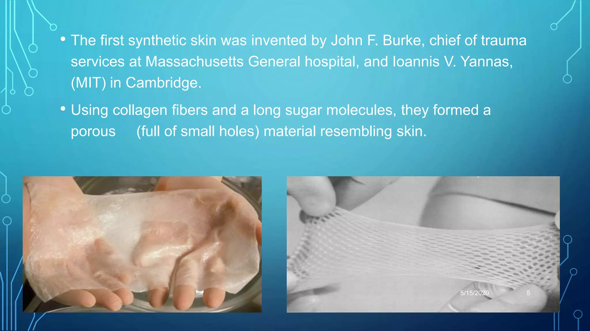 • The first synthetic skin was invented by John F. Burke, chief of trauma
services at Massachusetts General hospital, and Ioannis V. Yannas,
(MIT) in Cambridge.
• Using collagen fibers and a long sugar molecules, they formed a
porous (full of small holes) material resembling skin.
5/15/2020 5
 