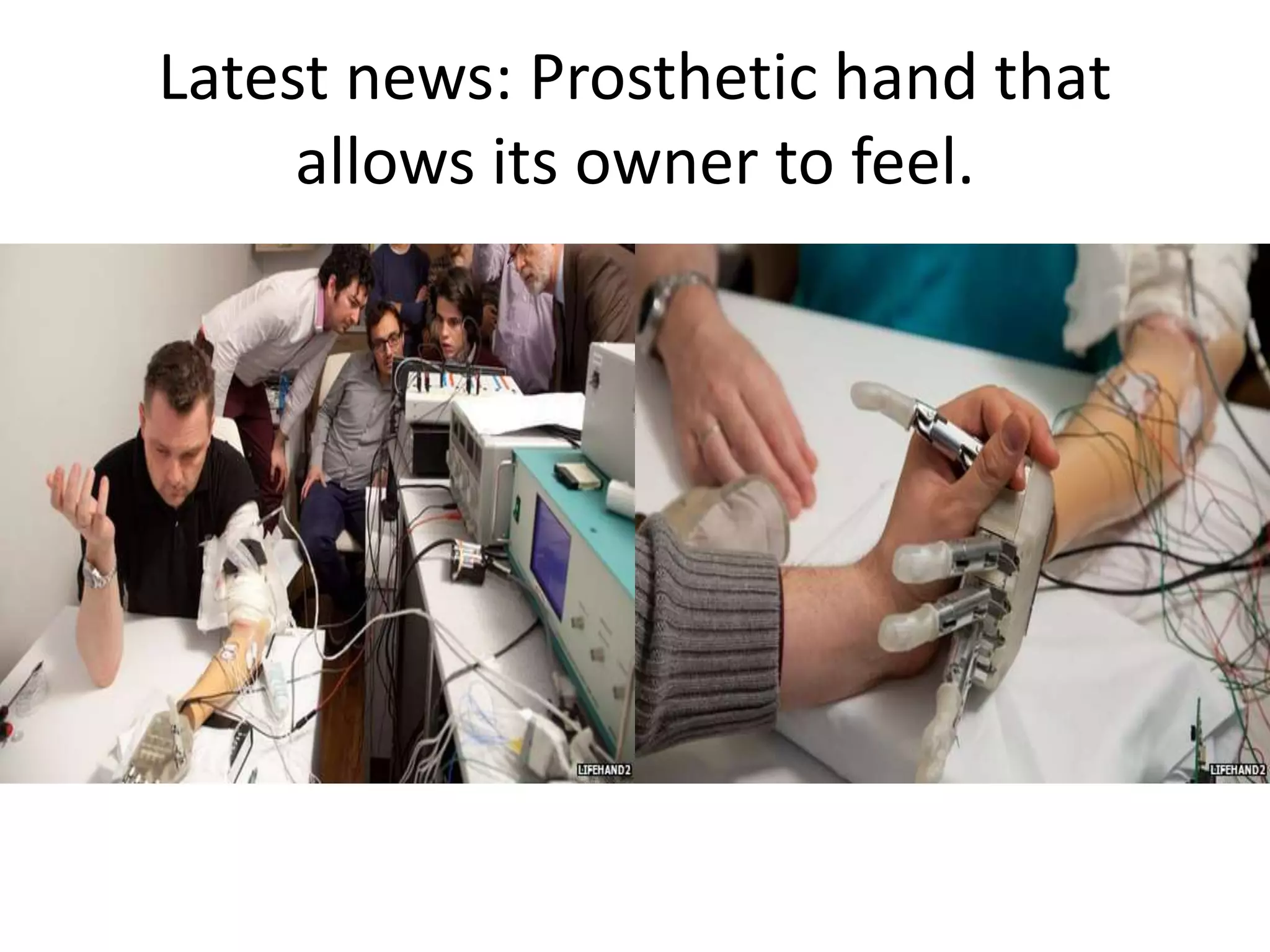 Latest news: Prosthetic hand that
allows its owner to feel.
 