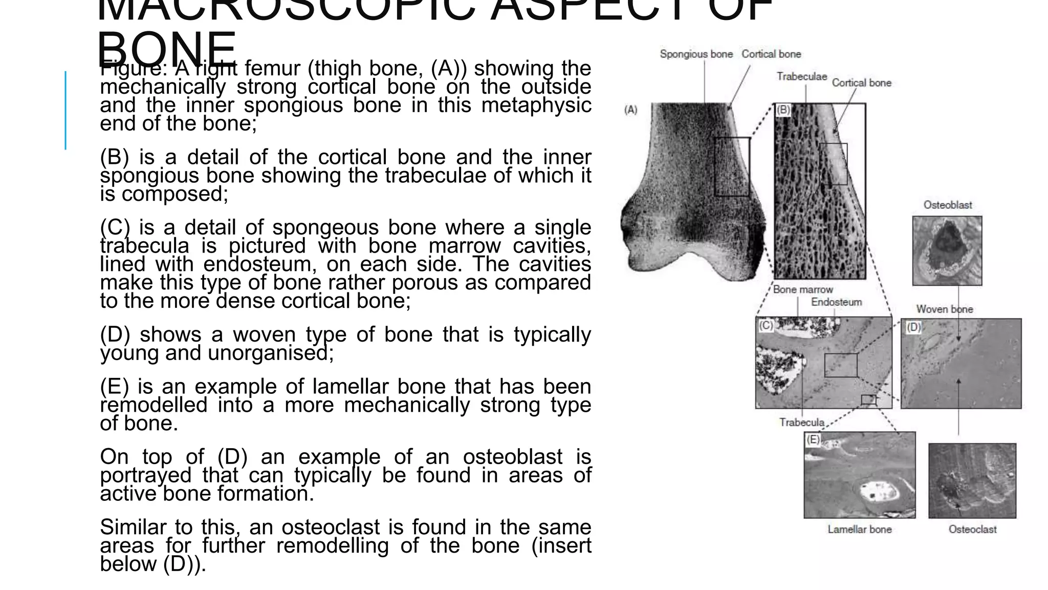 MACROSCOPIC ASPECT OF
BONE femur (thigh bone, (A)) showing the
Figure: A right
mechanically strong cortical bone on the outside
and the inner spongious bone in this metaphysic
end of the bone;
(B) is a detail of the cortical bone and the inner
spongious bone showing the trabeculae of which it
is composed;
(C) is a detail of spongeous bone where a single
trabecula is pictured with bone marrow cavities,
lined with endosteum, on each side. The cavities
make this type of bone rather porous as compared
to the more dense cortical bone;
(D) shows a woven type of bone that is typically
young and unorganised;
(E) is an example of lamellar bone that has been
remodelled into a more mechanically strong type
of bone.

On top of (D) an example of an osteoblast is
portrayed that can typically be found in areas of
active bone formation.
Similar to this, an osteoclast is found in the same
areas for further remodelling of the bone (insert
below (D)).

 