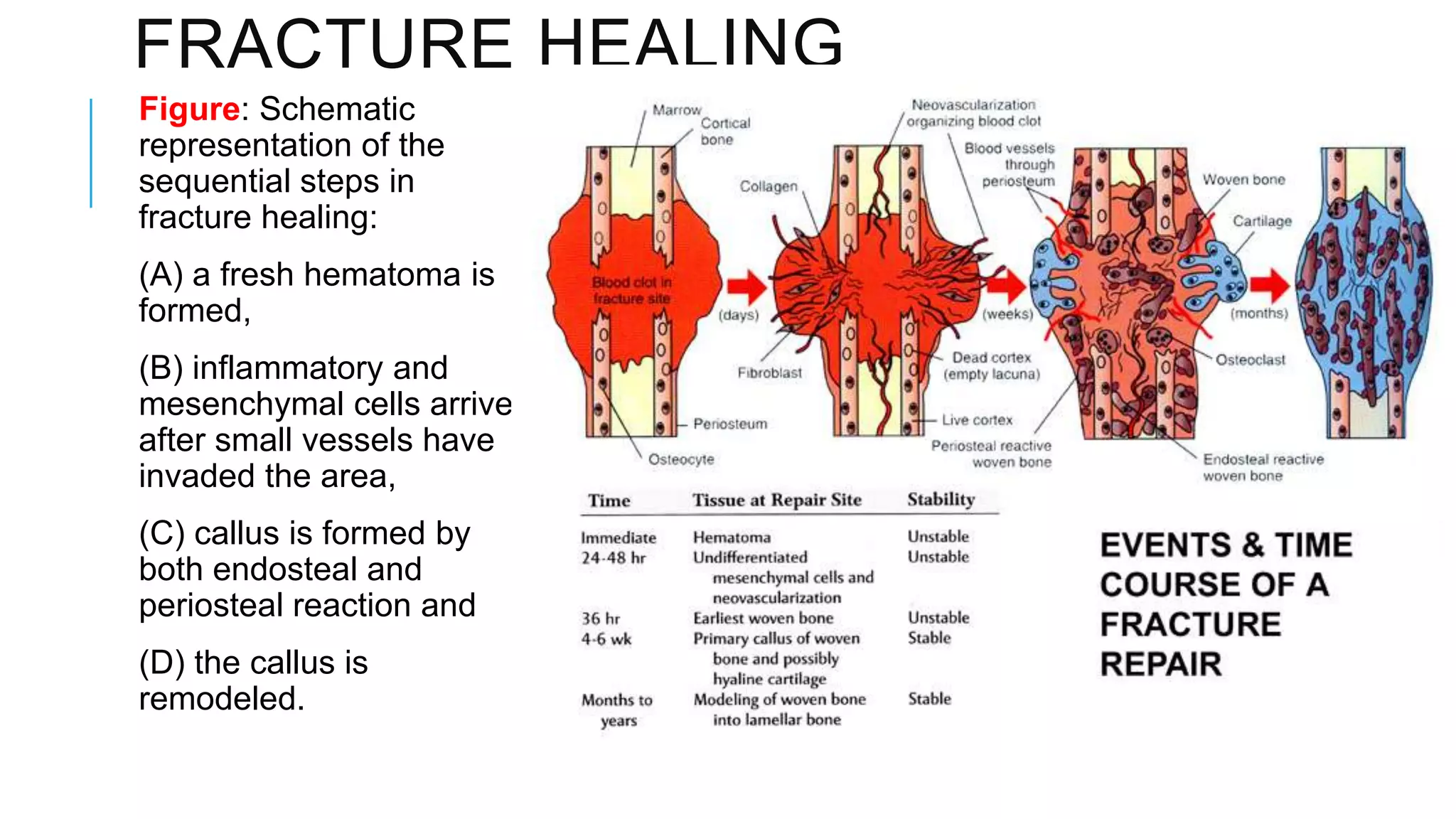 FRACTURE HEALING
Figure: Schematic
representation of the
sequential steps in
fracture healing:
(A) a fresh hematoma is
formed,
(B) inflammatory and
mesenchymal cells arrive
after small vessels have
invaded the area,
(C) callus is formed by
both endosteal and
periosteal reaction and
(D) the callus is
remodeled.

 
