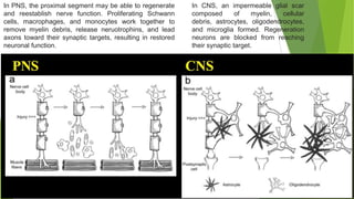 In PNS, the proximal segment may be able to regenerate
and reestablish nerve function. Proliferating Schwann
cells, macrophages, and monocytes work together to
remove myelin debris, release neruotrophins, and lead
axons toward their synaptic targets, resulting in restored
neuronal function.

In CNS, an impermeable glial scar
composed
of
myelin,
cellular
debris, astrocytes, oligodendrocytes,
and microglia formed. Regeneration
neurons are blocked from reaching
their synaptic target.

 