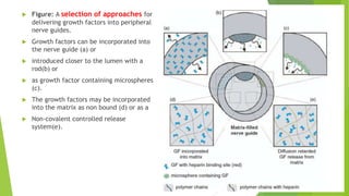

Figure: A selection of approaches for
delivering growth factors into peripheral
nerve guides.



Growth factors can be incorporated into
the nerve guide (a) or



introduced closer to the lumen with a
rod(b) or



as growth factor containing microspheres
(c).



The growth factors may be incorporated
into the matrix as non bound (d) or as a



Non-covalent controlled release
system(e).

 