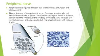 Peripheral nerve


Peripheral nerve injuries (PNI) can lead to lifetime loss of function and
disfigurement.



Figure: Anatomy of the peripheral nerve. The axons from the selected
fascicle are indicated in yellow. The Schwann cell myelin sheath is drawn to
demonstrate the wrapping of the cell body around the axon; however, the
myelin is compact and only a single dark ring is typically seen with histology
(right).

 
