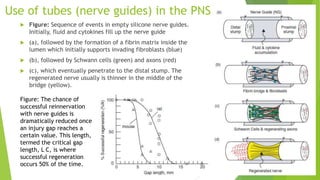 Use of tubes (nerve guides) in the PNS


Figure: Sequence of events in empty silicone nerve guides.
Initially, fluid and cytokines fill up the nerve guide



(a), followed by the formation of a fibrin matrix inside the
lumen which initially supports invading fibroblasts (blue)



(b), followed by Schwann cells (green) and axons (red)



(c), which eventually penetrate to the distal stump. The
regenerated nerve usually is thinner in the middle of the
bridge (yellow).

Figure: The chance of
successful reinnervation
with nerve guides is
dramatically reduced once
an injury gap reaches a
certain value. This length,
termed the critical gap
length, L C, is where
successful regeneration
occurs 50% of the time.

 