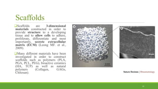Scaffolds
Scaffolds are 3-dimensional
materials constructed in order to
provide structure to a developing
tissue and to allow cells to adhere,
proliferate, differentiate and most
importantly, secrete extracellular
matrix (ECM) (Leong MF. et al.,
2009).
Many different materials have been
investigated in order to construct
scaffolds such as polymers (PLA,
PGA, PCL, PEG), bioactive ceramics
(HA, TCP) as well as natural
polymers (Collagen, GAGs,
Chitosan).
12
 