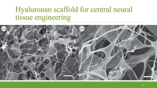 Hyaluronan scaffold for central neural
tissue engineering
29
 