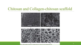 Chitosan and Collagen-chitosan scaffold
33
 