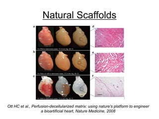 Natural Scaffolds
Ott HC et al., Perfusion-decellularized matrix: using nature's platform to engineer
a bioartificial heart, Nature Medicine, 2008
 