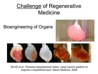 Challenge of Regenerative
Medicine
Bioengineering of Organs
Ott HC et al., Perfusion-decellularized matrix: using nature's platform to
engineer a bioartificial heart, Nature Medicine, 2008
 