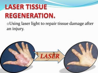 oUsing laser light to repair tissue damage after
an injury.
 