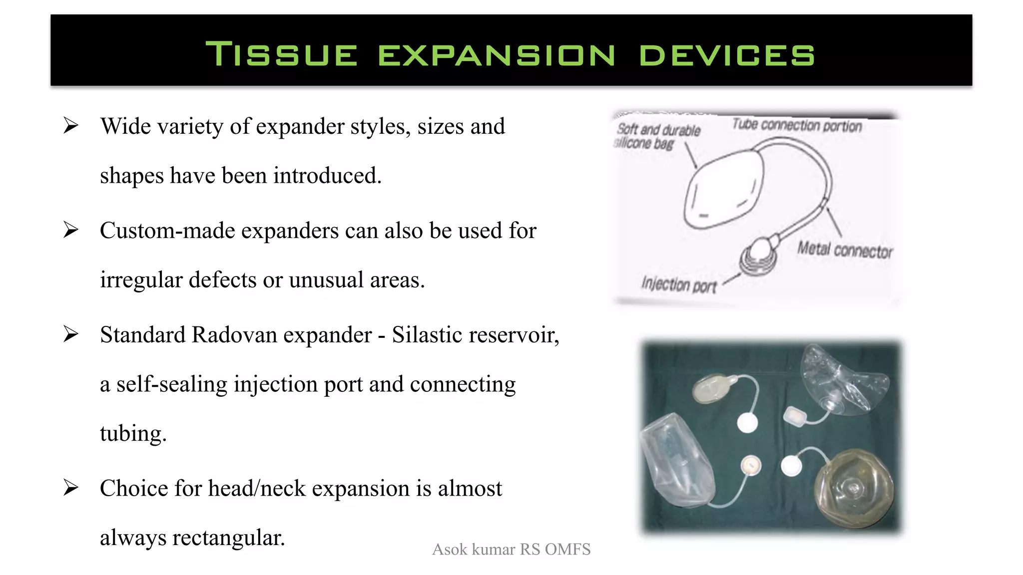 Tissue expander in omfs PDF