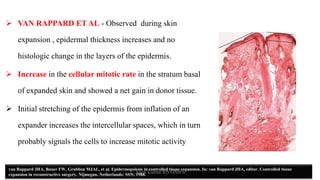 Tissue expander in omfs | PDF