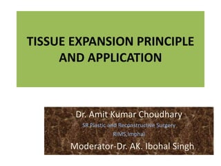 TISSUE EXPANSION PRINCIPLE
AND APPLICATION
Dr. Amit Kumar Choudhary
SR Plastic and Reconstructive Surgery
RIMS,Imphal
Moderator-Dr. AK. Ibohal Singh
 