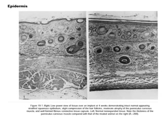 Tissue Expansion For Rfff Tissue expansion | PPTX