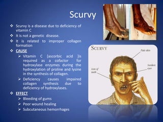 Scurvy
 Scurvy is a disease due to deficiency of
vitamin C
 It is not a genetic disease.
 It is related to improper collagen
formation
 CAUSE
 Vitamin C [ascorbic acid ]is
required as a cofactor for
hydroxylase enzymes during the
hydroxylation of proline and lysine
in the synthesis of collagen.
 Deficiency causes impaired
collagen synthesis due to
deficiency of hydroxylases.
 EFFECT
 Bleeding of gums
 Poor wound healing
 Subcutaneous hemorrhages
 
