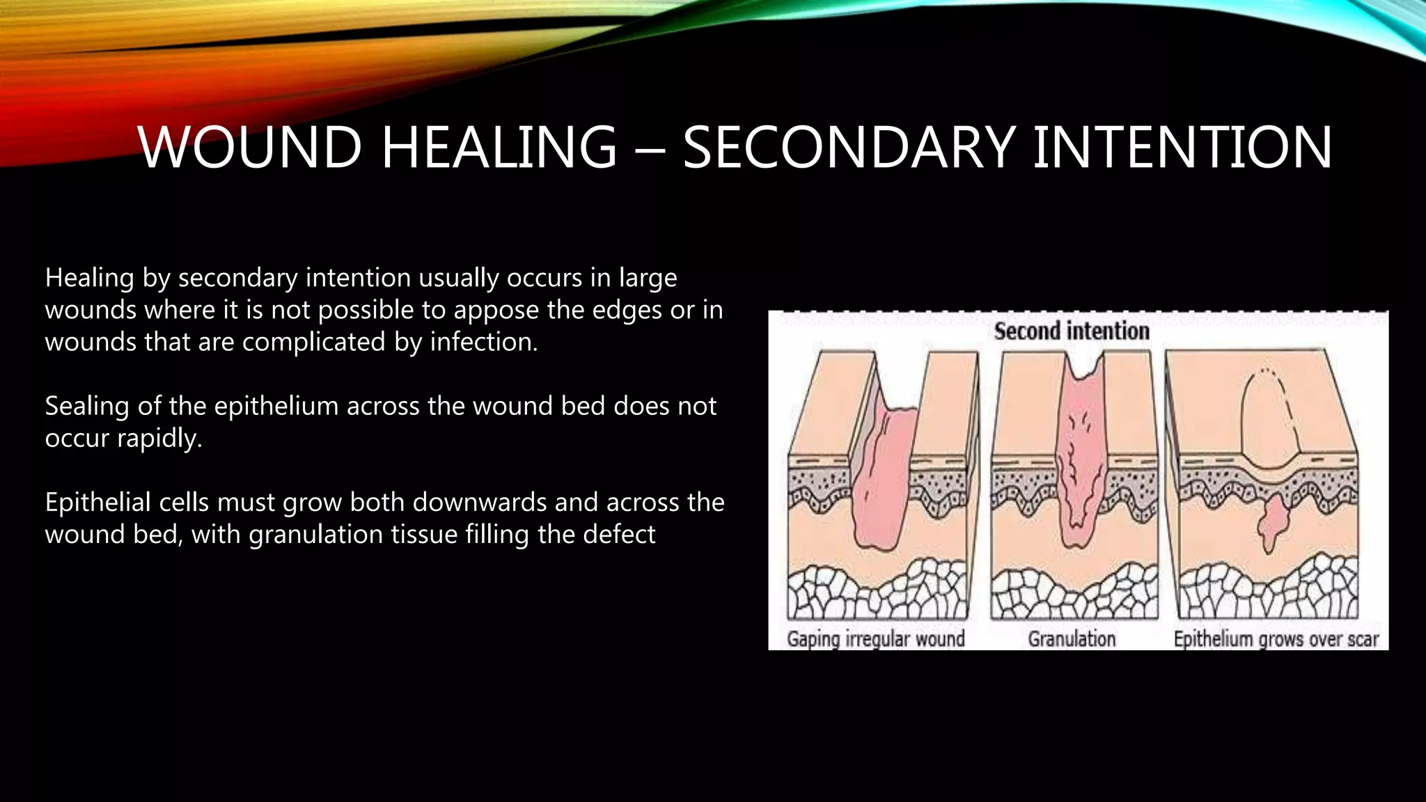 wound healing | PPTX